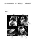 Automatic Determination Of Field Of View In Cardiac MRI diagram and image