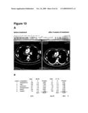 MEANS AND METHODS FOR THE TREATMENT OF TUMOROUS DISEASES diagram and image