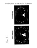 MEANS AND METHODS FOR THE TREATMENT OF TUMOROUS DISEASES diagram and image