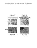 MICROSPHERE-BASED COMPOSITION FOR PREVENTING AND/OR REVERSING NEW-ONSET AUTOIMMUNE DIABETES diagram and image