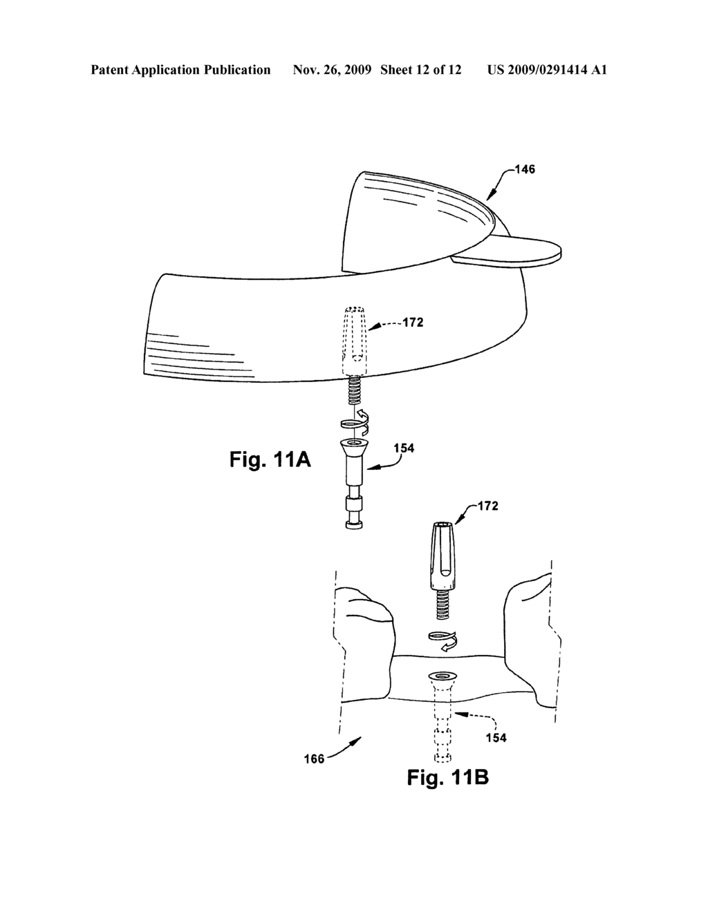 METHOD FOR FORMING A DENTAL IMPLANT - diagram, schematic, and image 13