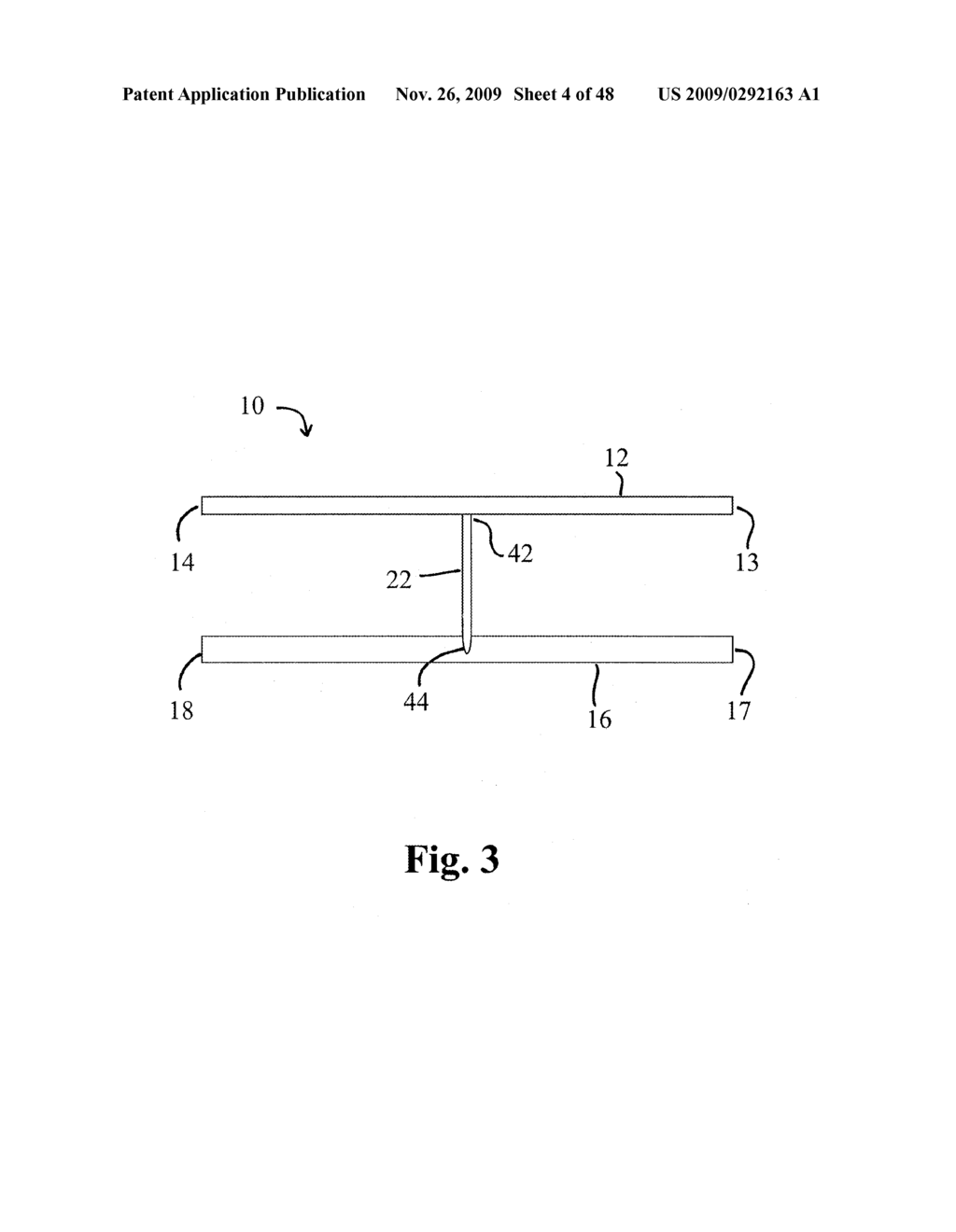 DEVICES AND METHODS FOR ACHIEVING THE LAPAROSCOPIC DELIVERY OF A DEVICE - diagram, schematic, and image 05