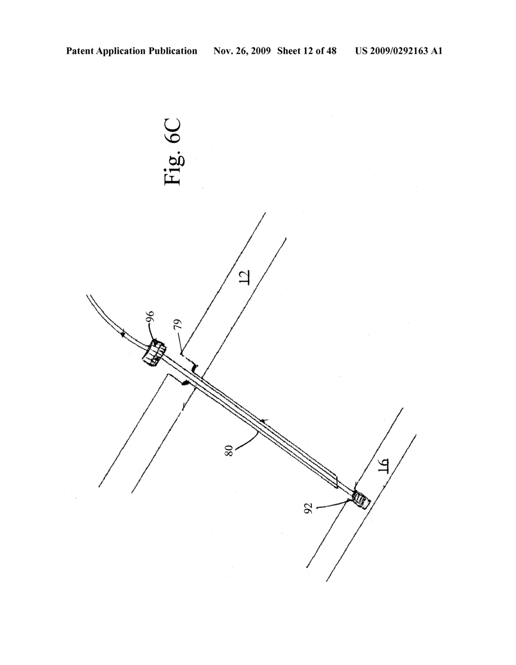 DEVICES AND METHODS FOR ACHIEVING THE LAPAROSCOPIC DELIVERY OF A DEVICE - diagram, schematic, and image 13