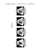 IMAGE PROCESSING APPARATUS AND COMPUTER PROGRAM PRODUCT diagram and image