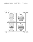 TASK-LESS OPTICAL MAPPING OF BRAIN FUNCTION USING RESTING STATE FUNCTIONAL CONNECTIVITY diagram and image