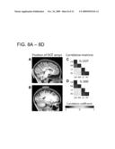 TASK-LESS OPTICAL MAPPING OF BRAIN FUNCTION USING RESTING STATE FUNCTIONAL CONNECTIVITY diagram and image