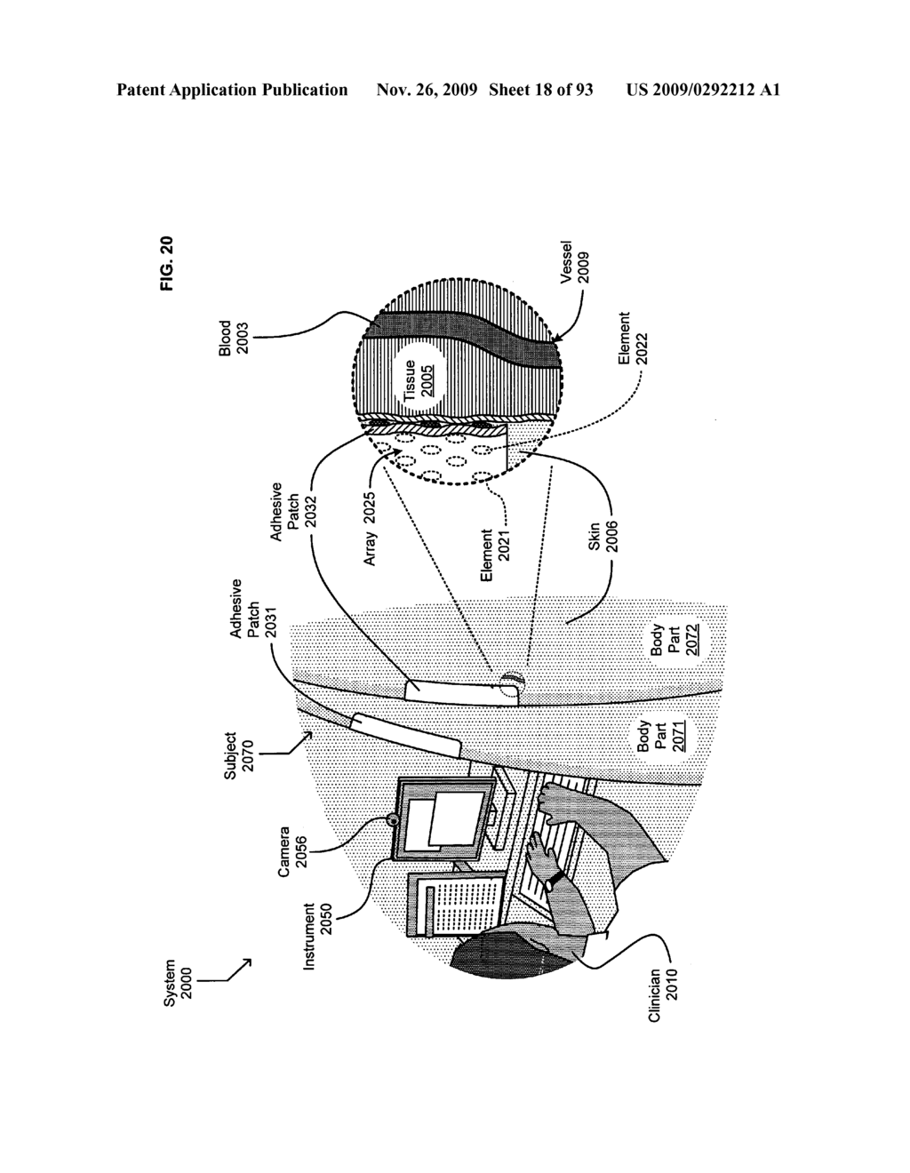 Circulatory monitoring systems and methods - diagram, schematic, and image 19