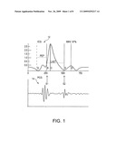 IMPEDANCE CARDIOGRAPHY SYSTEM AND METHOD diagram and image