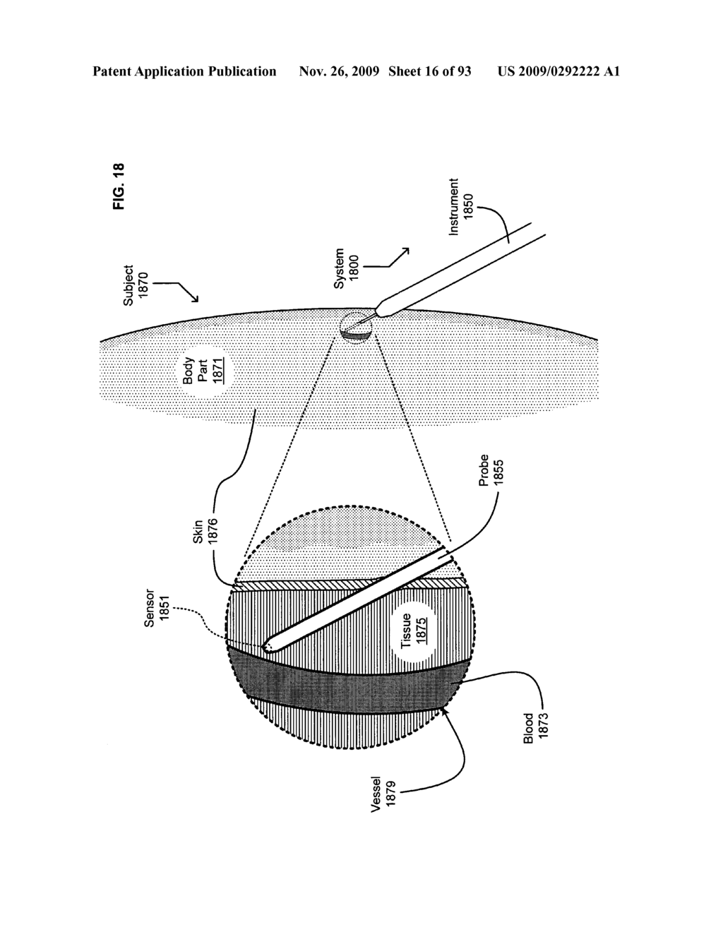 Circulatory monitoring systems and methods - diagram, schematic, and image 17