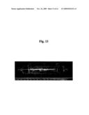 SYSTEMS AND METHODS OF BLOOD-BASED THERAPIES HAVING A MICROFLUIDIC MEMBRANELESS EXCHANGE DEVICE diagram and image