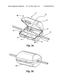 Nasal Cannula Cover diagram and image