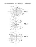 Stylet Handle Attachment Device diagram and image