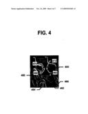 System and Method for Supporting The Weight Of A Body Using Osseopercutaneous Implants diagram and image