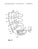 METHODS AND APPARATUS FOR TOOLS IN AXIALLY ORIENTED BORES THROUGH SPINAL VERTEBRAE diagram and image