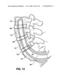 METHODS AND APPARATUS FOR TOOLS IN AXIALLY ORIENTED BORES THROUGH SPINAL VERTEBRAE diagram and image