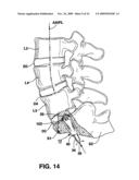 METHODS AND APPARATUS FOR TOOLS IN AXIALLY ORIENTED BORES THROUGH SPINAL VERTEBRAE diagram and image