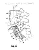 METHODS AND APPARATUS FOR TOOLS IN AXIALLY ORIENTED BORES THROUGH SPINAL VERTEBRAE diagram and image