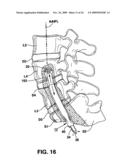 METHODS AND APPARATUS FOR TOOLS IN AXIALLY ORIENTED BORES THROUGH SPINAL VERTEBRAE diagram and image