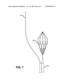 Devices for Restoring Blood Flow and Embolus Removal During Acute Ischemic Stroke diagram and image