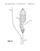 Devices for Restoring Blood Flow and Embolus Removal During Acute Ischemic Stroke diagram and image