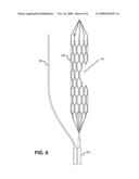 Devices for Restoring Blood Flow and Embolus Removal During Acute Ischemic Stroke diagram and image