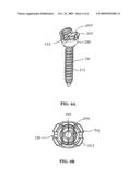 SPINAL FIXATION SYSTEM diagram and image