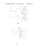 LUMBAR INTERSPINOUS PROSTHESIS AND ITS APPLICATIONS diagram and image