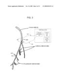 ELECTRICAL STIMULATION TREATMENT OF HYPOTENSION diagram and image