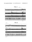 ELECTRICAL STIMULATION TREATMENT OF HYPOTENSION diagram and image