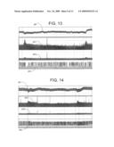 ELECTRICAL STIMULATION TREATMENT OF HYPOTENSION diagram and image