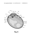 Thermoelectric Generator for Implants and Embedded Devices diagram and image