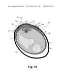 Thermoelectric Generator for Implants and Embedded Devices diagram and image