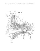 WEARABLE ALARM SYSTEM FOR A PROSTHETIC HEARING IMPLANT diagram and image