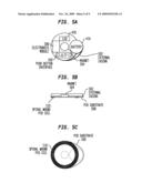 WEARABLE ALARM SYSTEM FOR A PROSTHETIC HEARING IMPLANT diagram and image