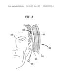 WEARABLE ALARM SYSTEM FOR A PROSTHETIC HEARING IMPLANT diagram and image