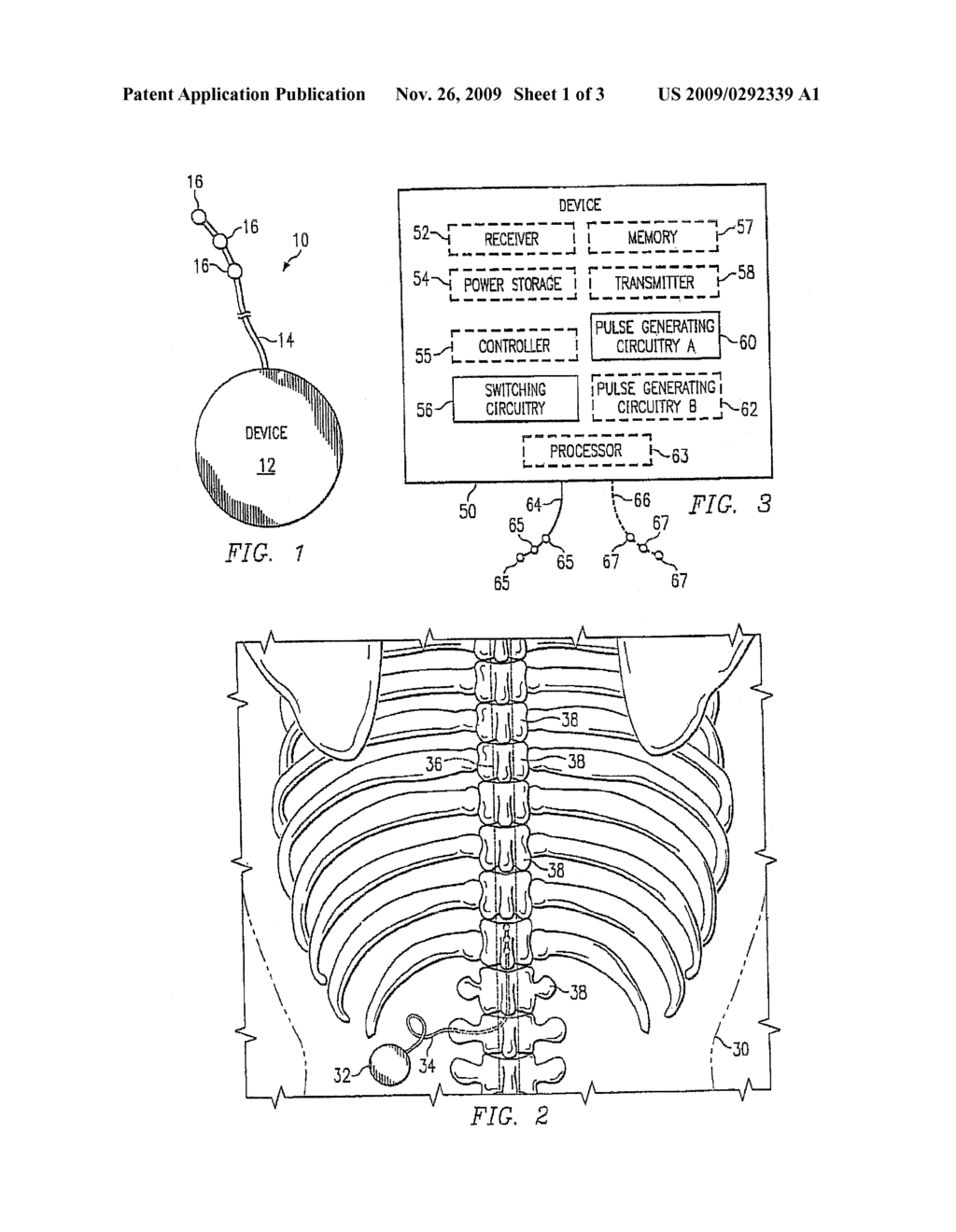 METHOD AND SYSTEM FOR ENERGY CONSERVATION IN IMPLANTABLE STIMULATION DEVICES - diagram, schematic, and image 02