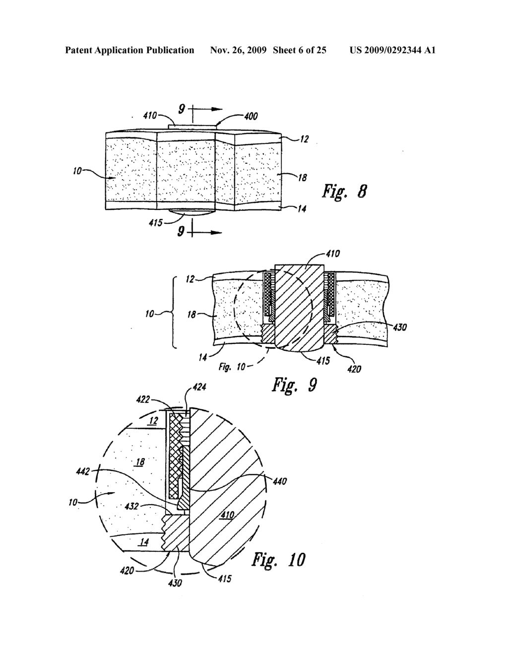 METHODS AND SYSTEMS FOR INTRACRANIAL NEUROSTIMULATION AND/OR SENSING - diagram, schematic, and image 07