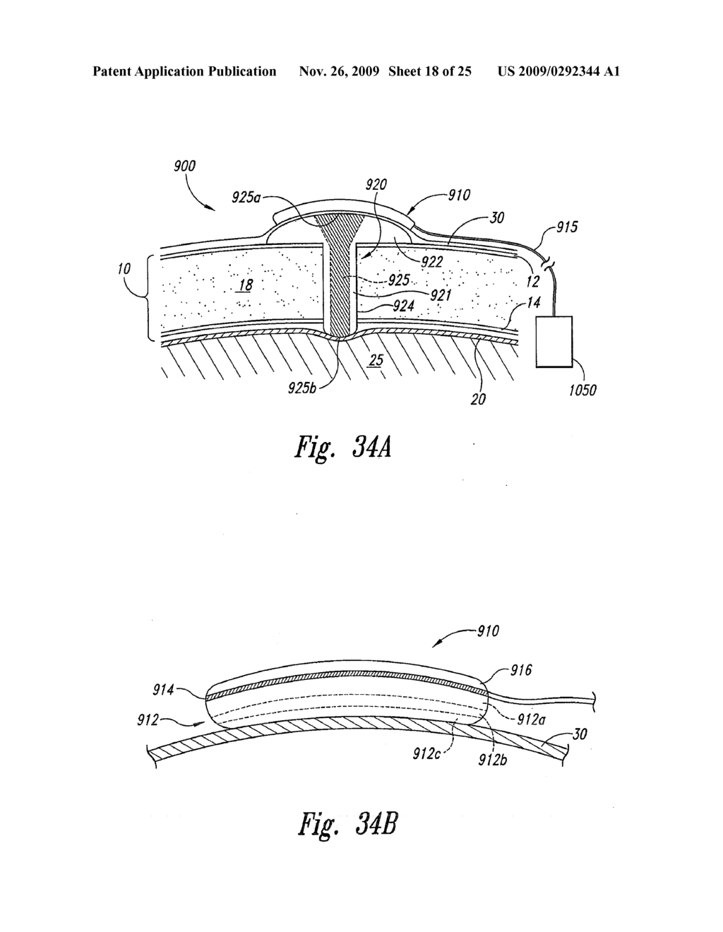 METHODS AND SYSTEMS FOR INTRACRANIAL NEUROSTIMULATION AND/OR SENSING - diagram, schematic, and image 19