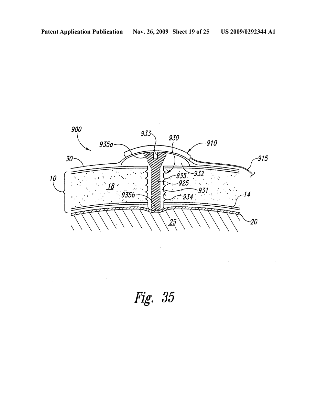 METHODS AND SYSTEMS FOR INTRACRANIAL NEUROSTIMULATION AND/OR SENSING - diagram, schematic, and image 20