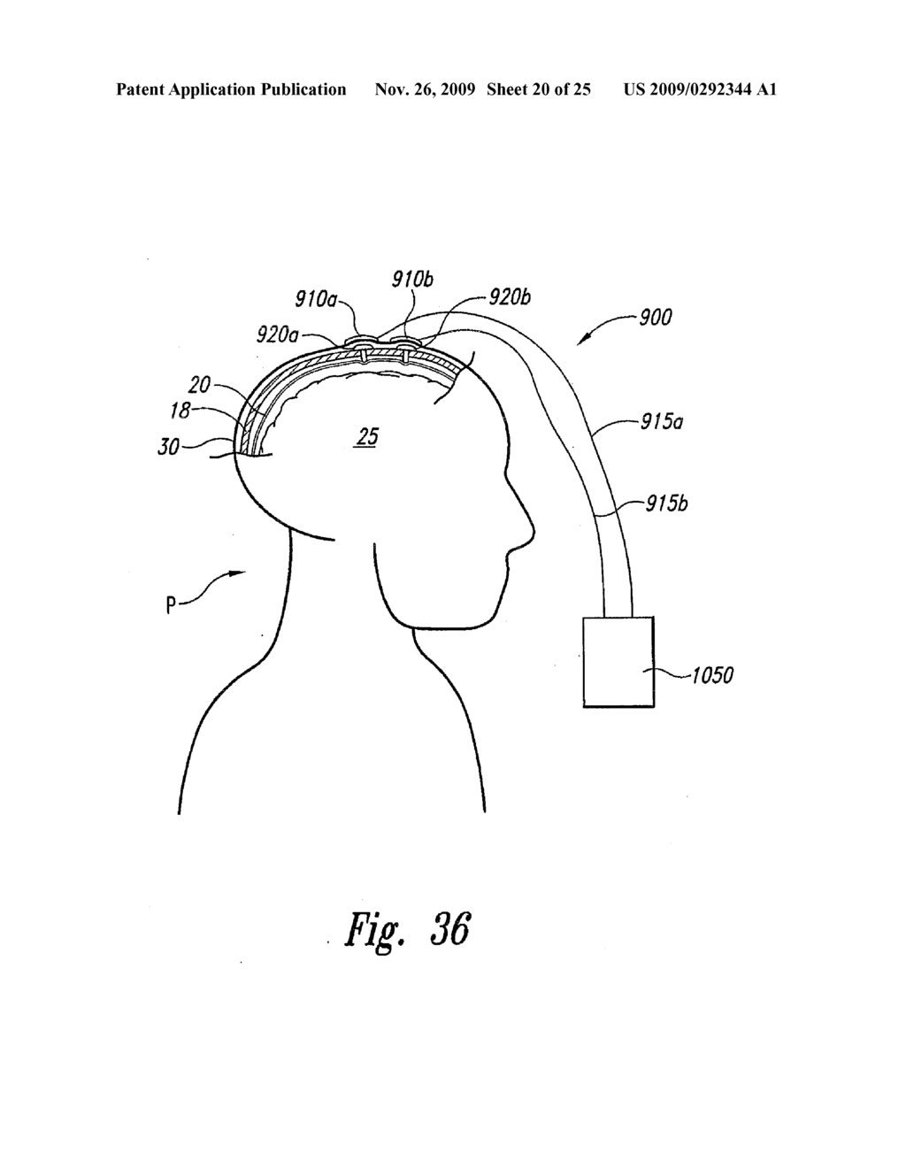 METHODS AND SYSTEMS FOR INTRACRANIAL NEUROSTIMULATION AND/OR SENSING - diagram, schematic, and image 21