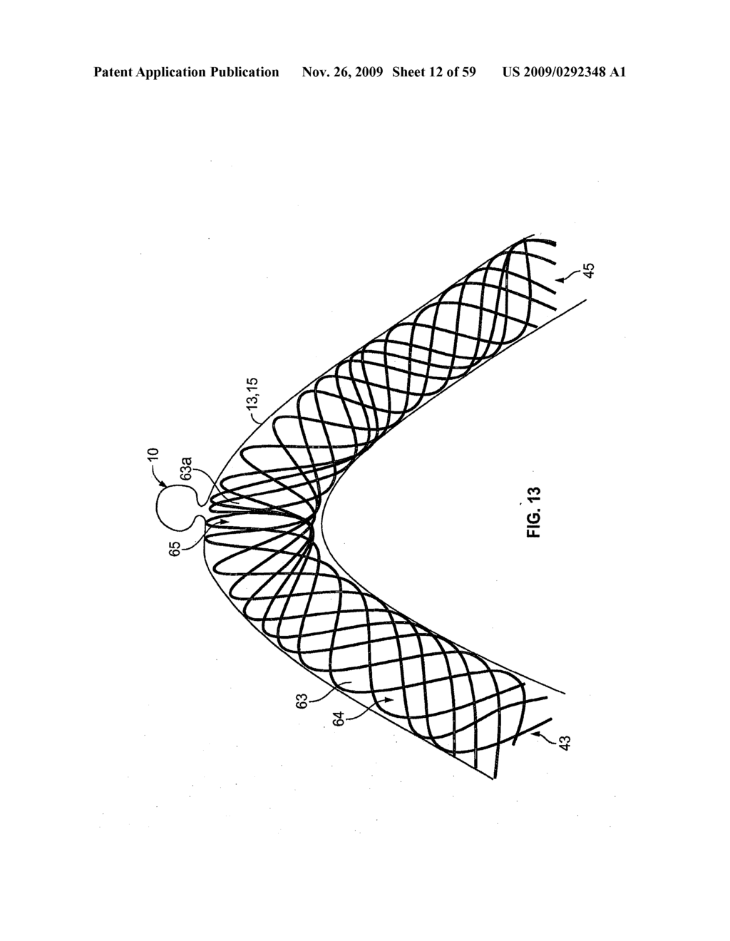 VASCULAR STENTING AND OTHER PROCEDURES - diagram, schematic, and image 13