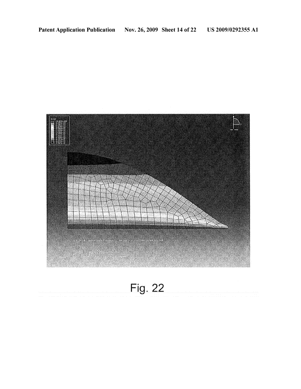 INTRAOCULAR, ACCOMMODATING LENS AND METHODS OF USE - diagram, schematic, and image 15