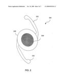 REDUCED PROFILE INTRAOCULAR LENS diagram and image