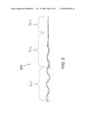 INTERVERTEBRAL PROSTHESIS diagram and image