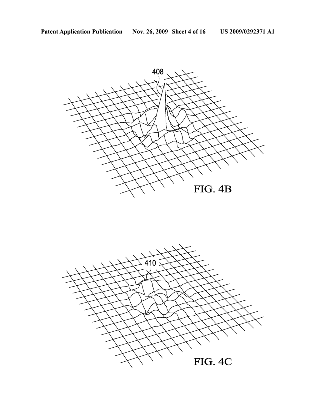 Correlated Magnetic Prosthetic Device and Method for Using the Correlated Magnetic Prosthetic Device - diagram, schematic, and image 05