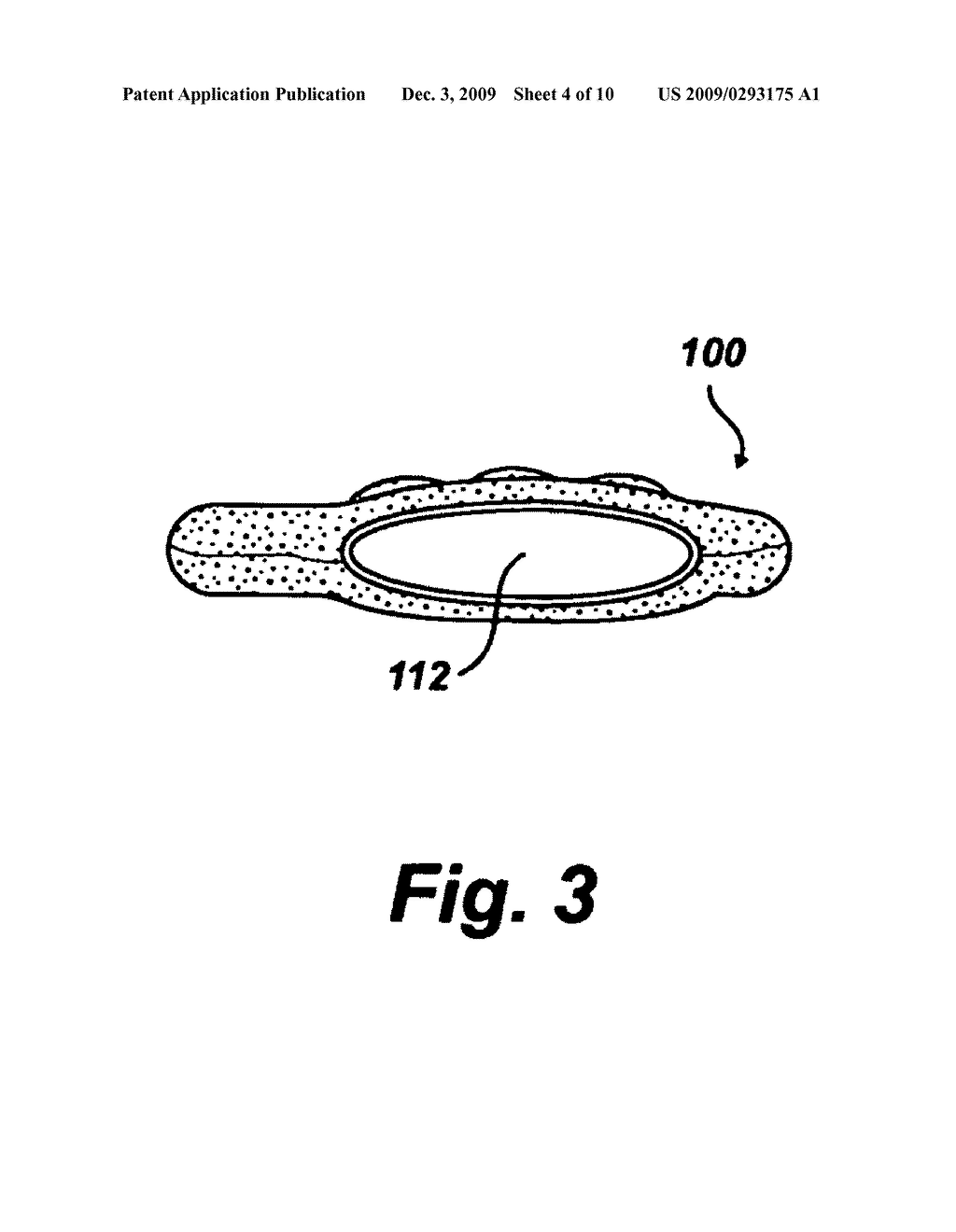 Disposable and ambidextrous glove sander - diagram, schematic, and image 05