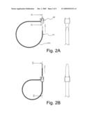 CONSTRICTIVE BAND diagram and image