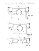 Flange hole repair diagram and image