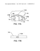 METHOD OF ASSEMBLING AN ELECTRODE ARRAY THAT INCLUDES A PLASTICALLY DEFORAMBLE CARRIER diagram and image