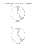 Plant Protection Apparatus diagram and image